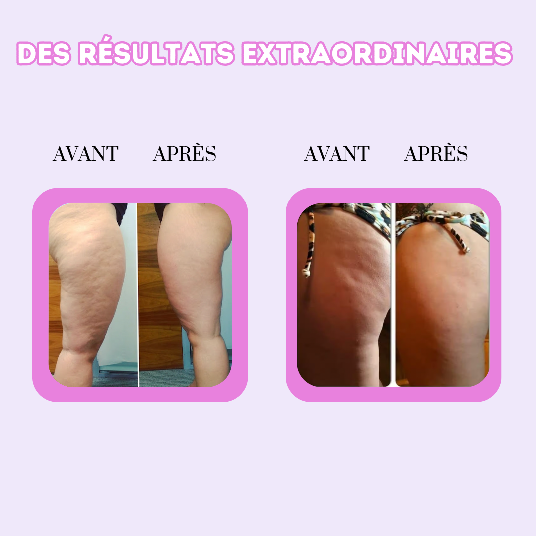 Rouleau de Massage Anti Cellulite